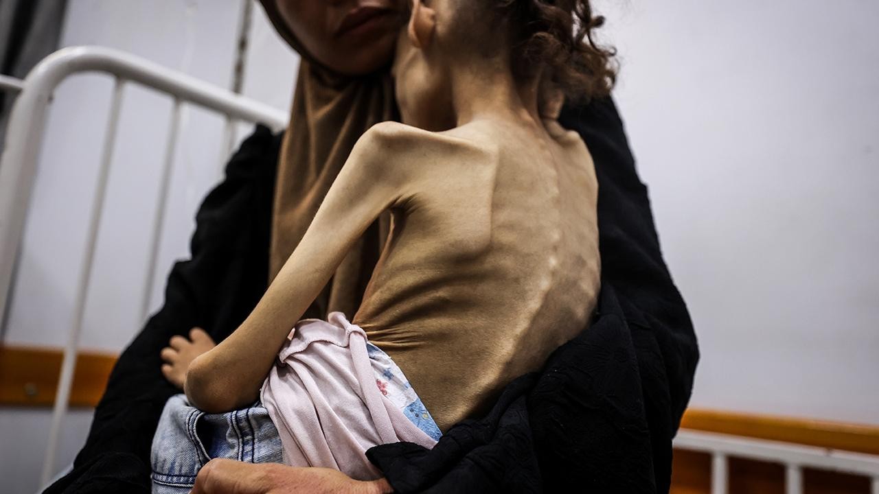 Gazze’de 9 yaşındaki Meryem, 25 kilodan 10 kiloya düştü