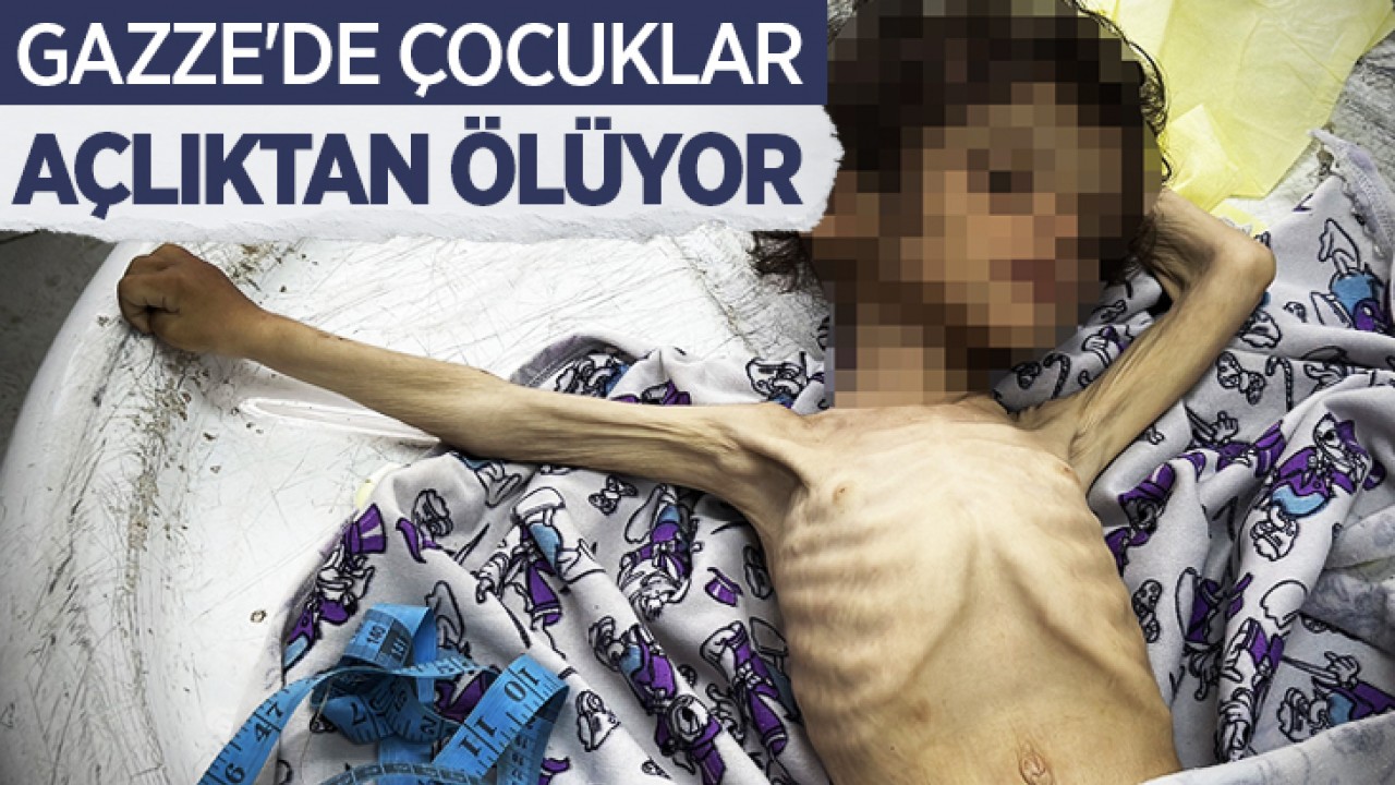 Gazze’de çocuklar açlıktan ölüyor