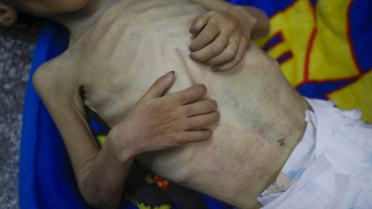 Gazze’de son 24 saatte 5 kişi daha açlıktan hayatını kaybetti