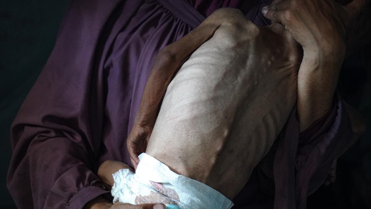 Gazze’de son 24 saatte 5 Filistinli daha açlıktan hayatını kaybetti