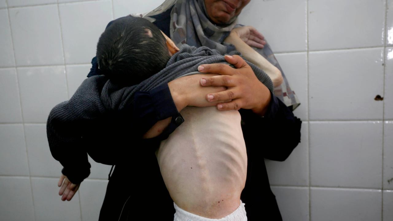 İsrail'in kıtlığı dayattığı Gazze'de son 24 saatte 8 kişi daha açlıktan hayatını kaybetti