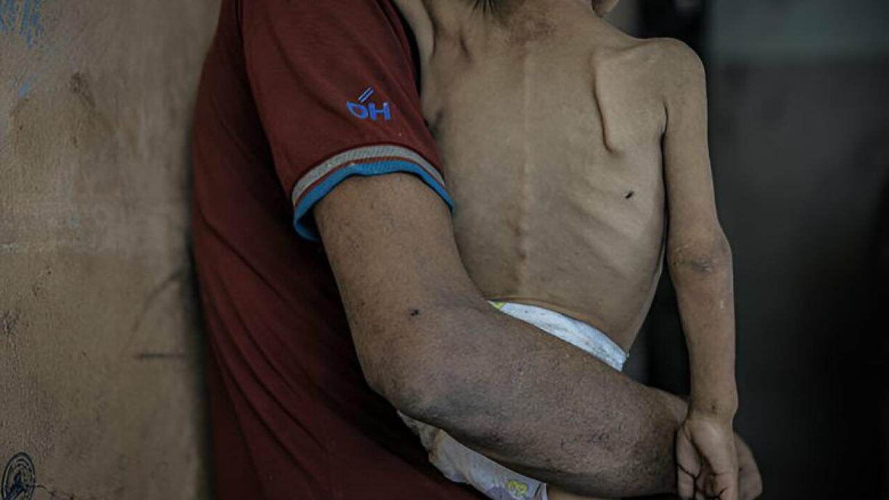 İsrail'in kıtlığı dayattığı Gazze’de açlıktan ölenlerin sayısı 263’e yükseldi