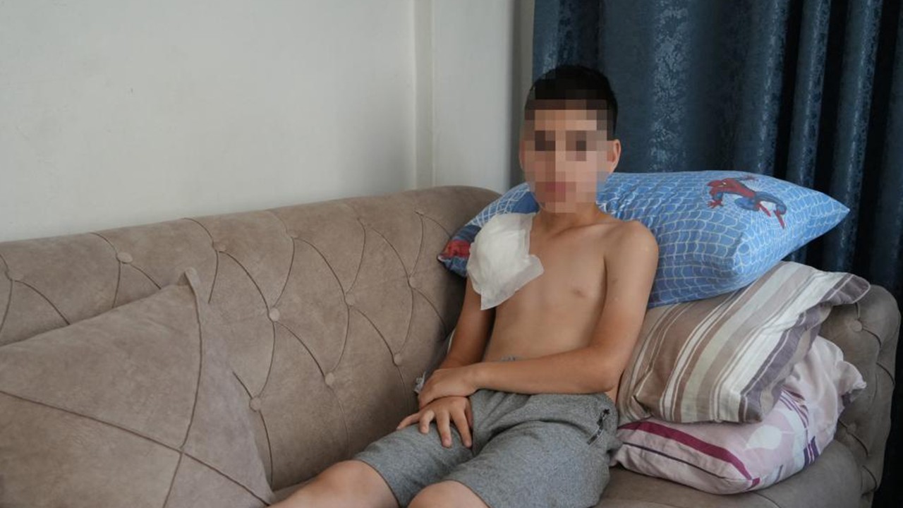 Köpeğin saldırdığı 11 yaşındaki çocuğun kolu felç kaldı
