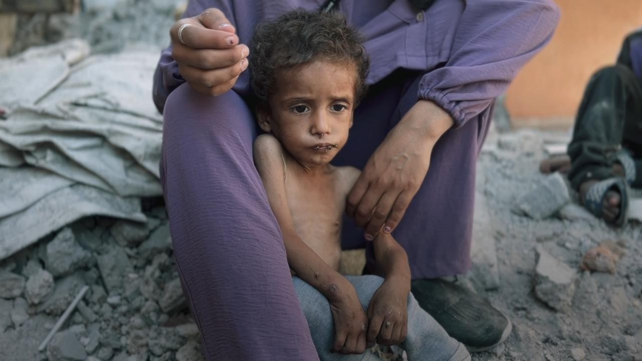 DSÖ: Gazze'de sadece bu yıl yetersiz beslenme nedeniyle 206 kişi öldü