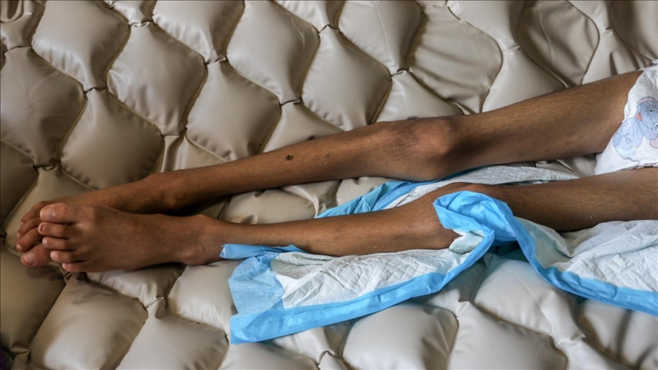 İsrail'in kıtlığı dayattığı Gazze'de son 24 saatte 2'si çocuk 6 kişi daha açlıktan hayatını kaybetti