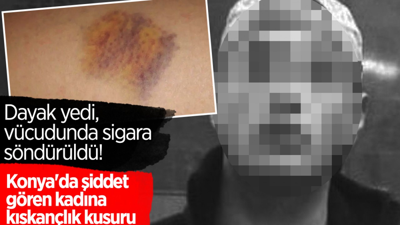 Dayak yedi, vücudunda sigara söndürüldü! Konya'da şiddet gören kadına ‘kıskançlık’ kusuru