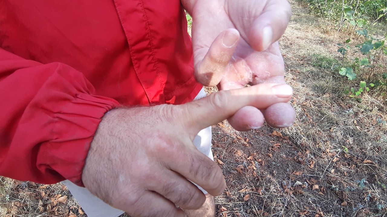 Ayının saldırısına uğrayan çiftçi dehşet anlarını anlattı: "Parmağımı kopardı"