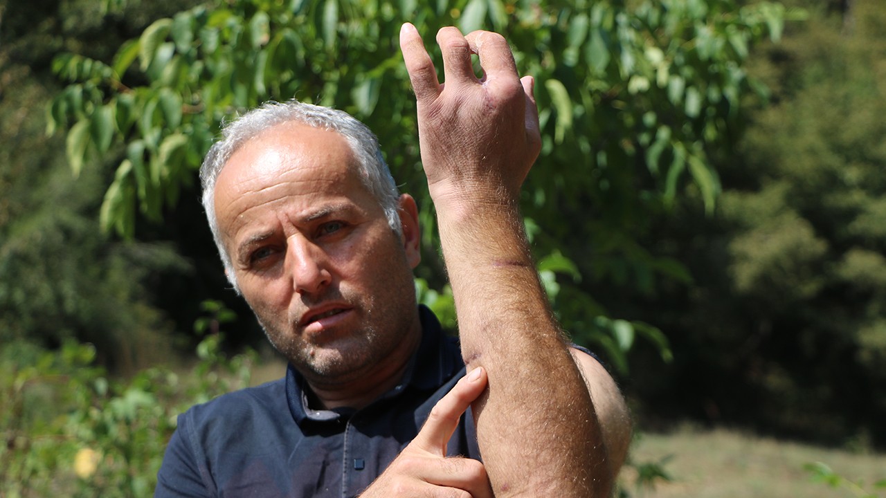 Babası gibi ayı saldırısına uğradı; parmağı koptu