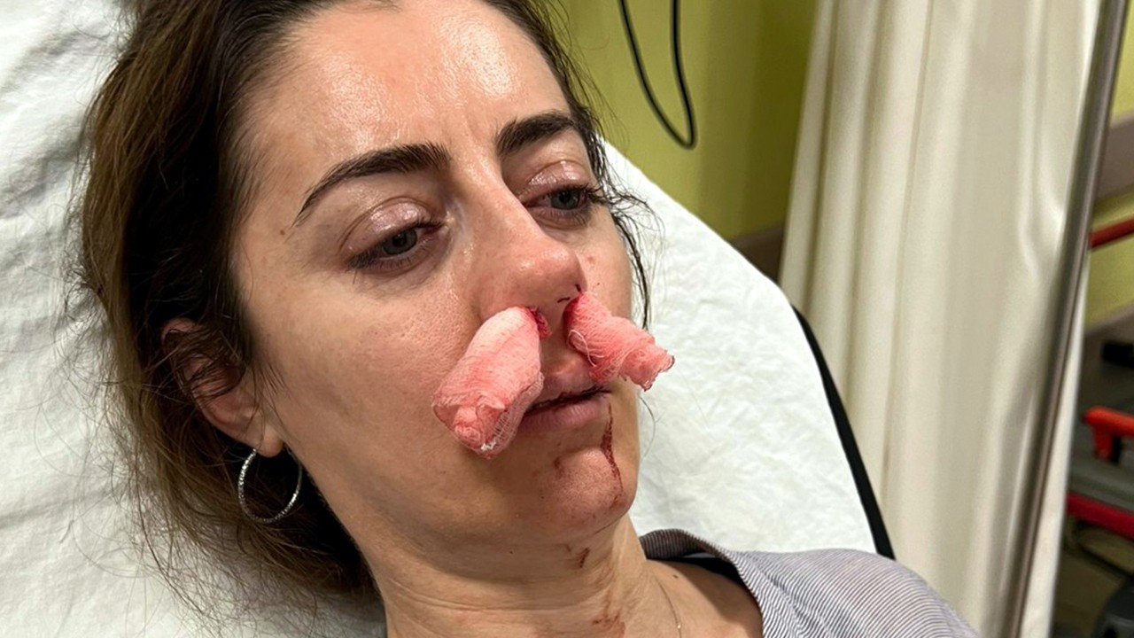 Eşinin sevgilisi sandığı kadını darbettiği 'otomobil kapısı', 'silah' sayıldı