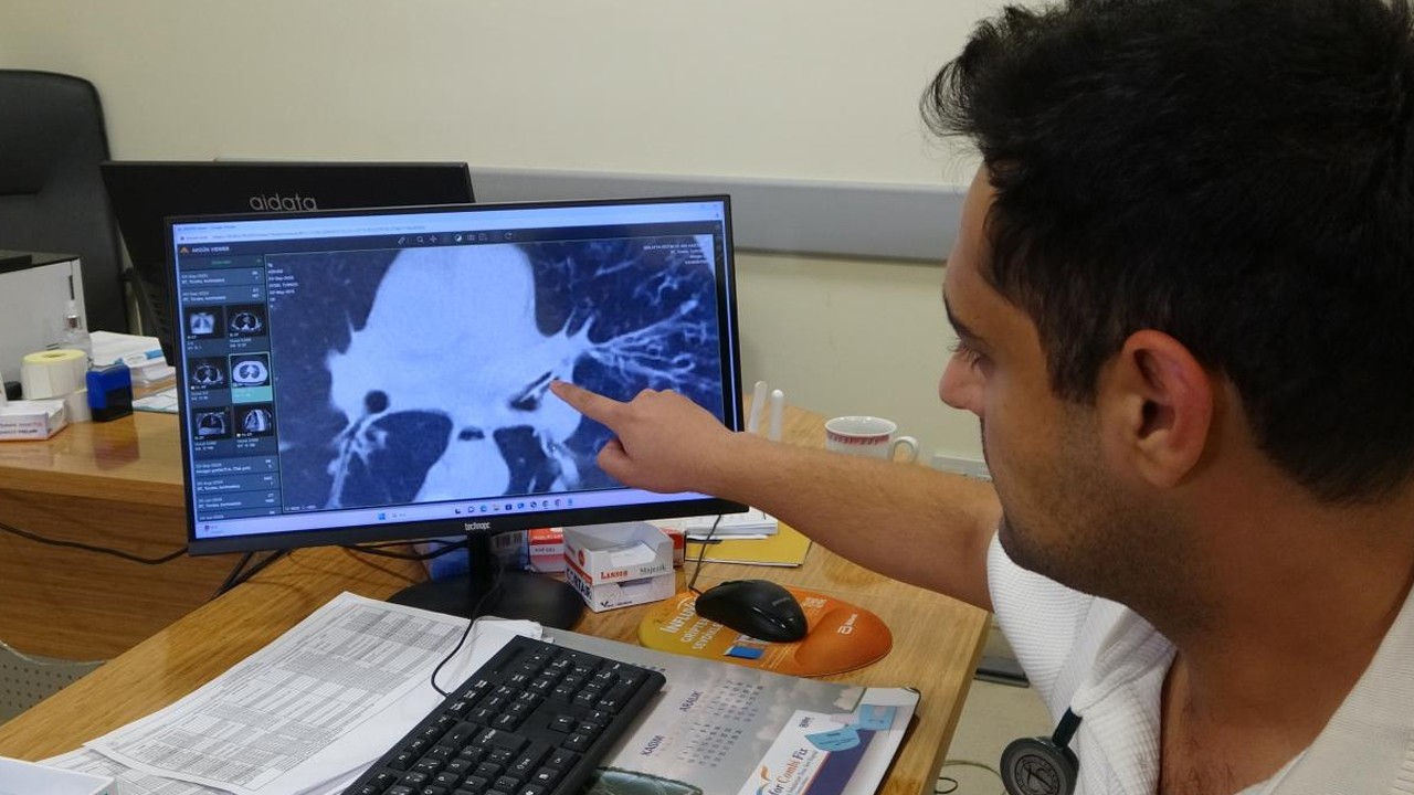 Aylarca kanser sandılar, gerçek 'kabak çekirdeği' çıktı