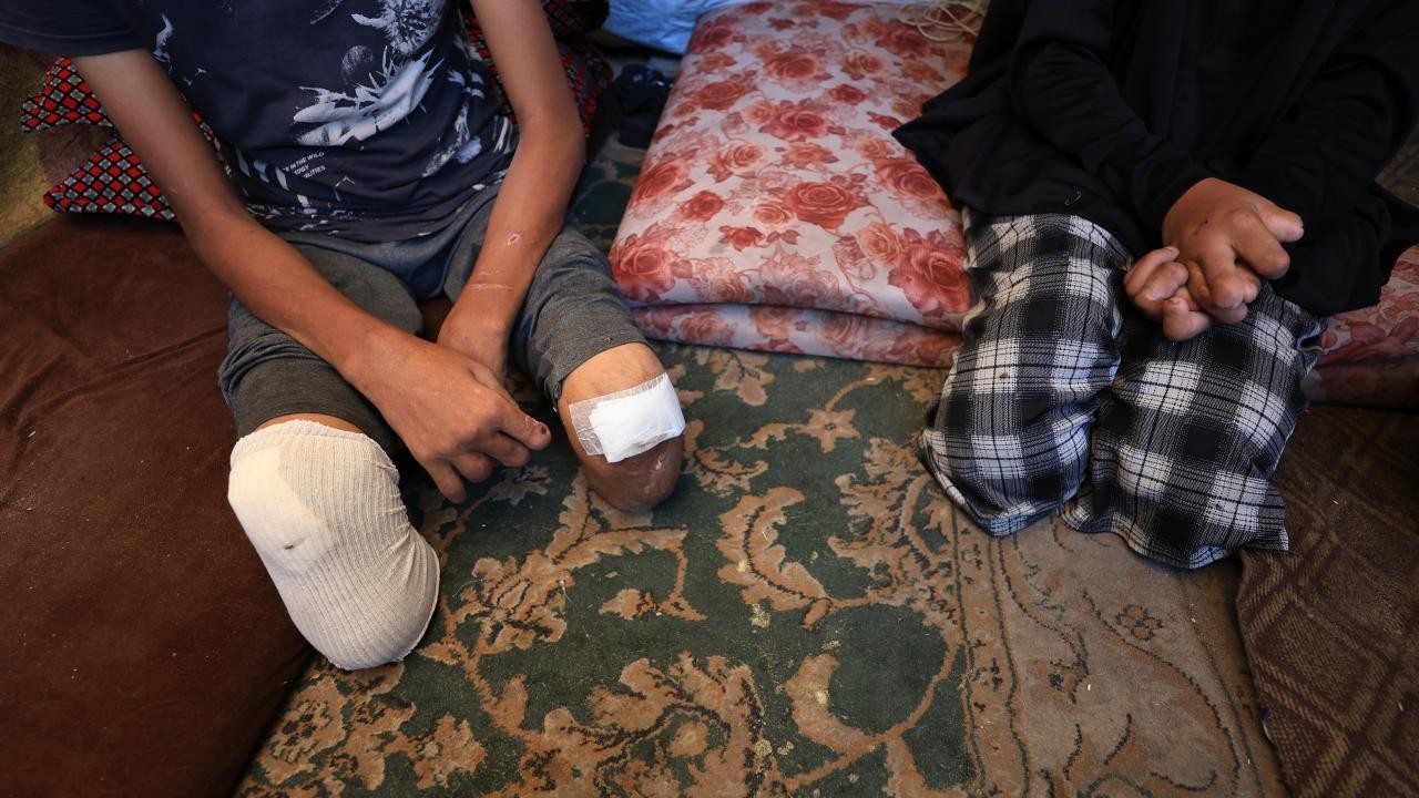 BM Komiseri: 7 Ekim'den bu yana Gazze'de 4 bin çocuk ampute edildi