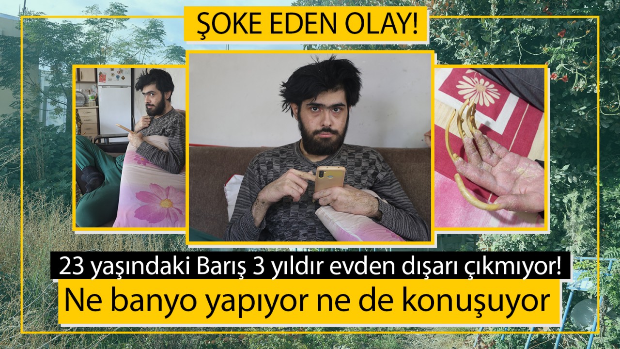 Şoke eden olay! 23 yaşındaki Barış 3 yıldır evden dışarı çıkmıyor: Ne banyo yapıyor ne de konuşuyor