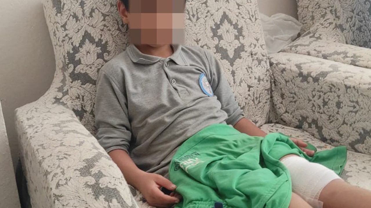 Okul yolunda başıboş köpeğin saldırısına uğradı