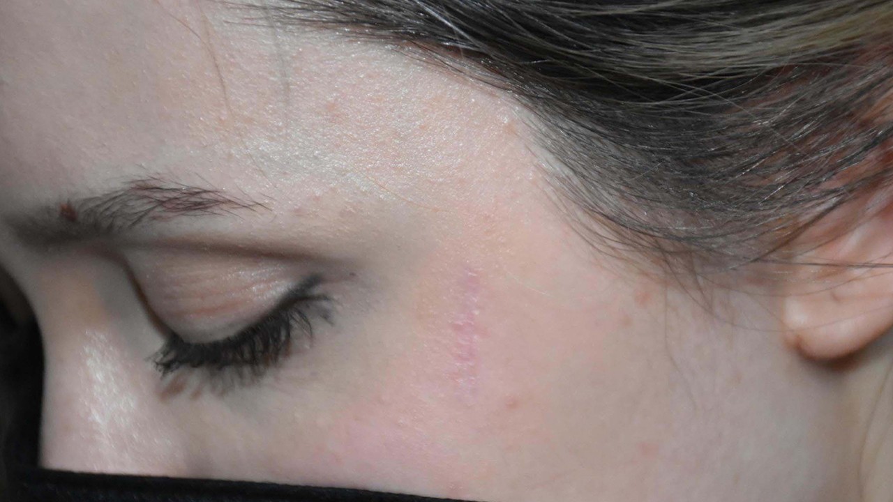 Betül'ü boynundan yaralayan komşu oğluna 18 yıl 8 ay hapis cezası