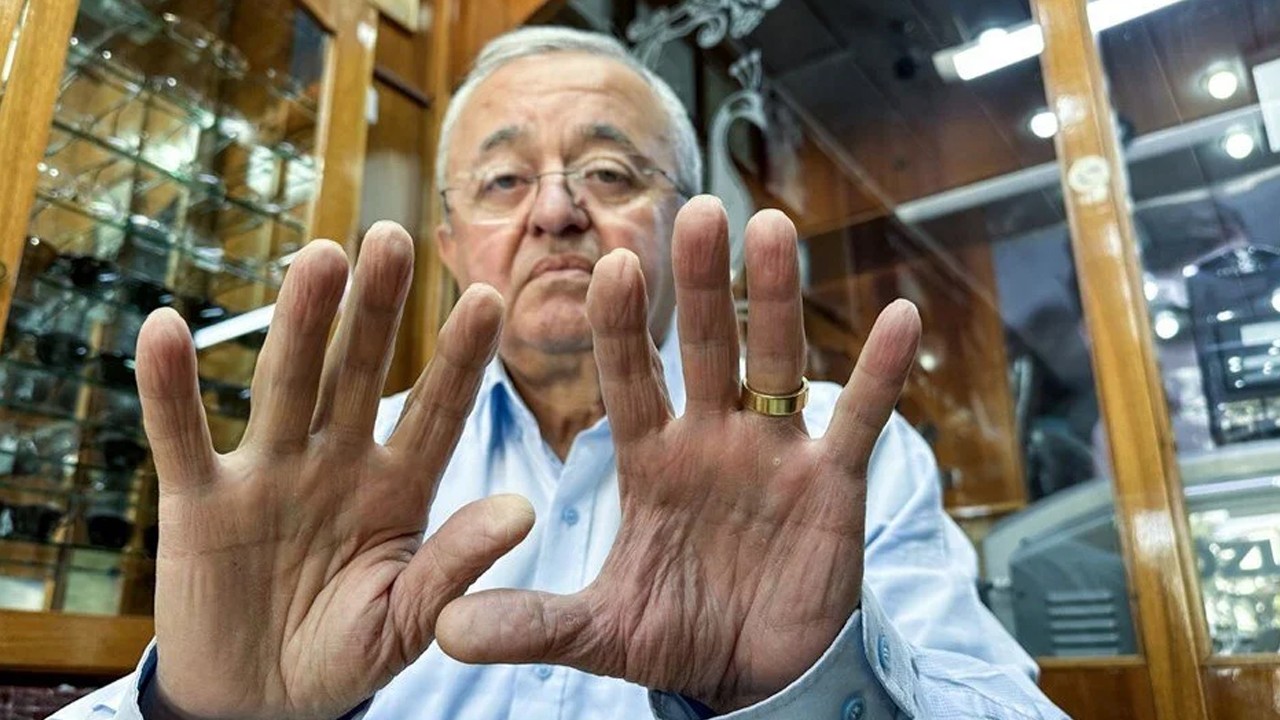 Ehliyet yenilerken gerçek ortaya çıktı: Yaptığı iş yüzünden parmak izi silinmiş