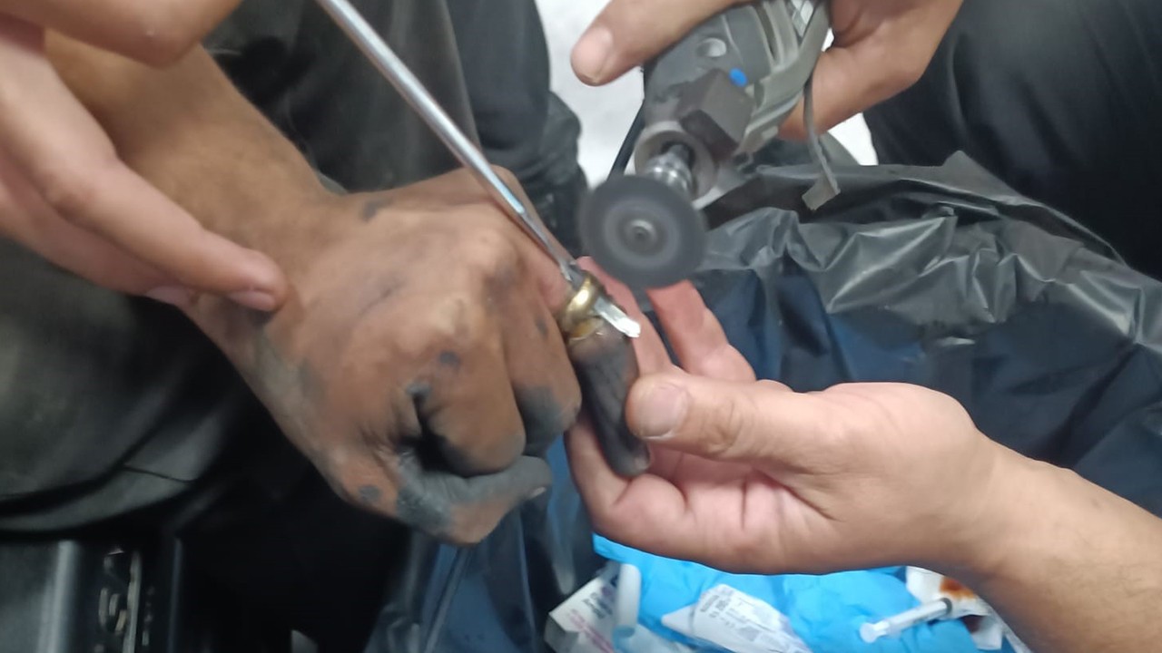 Parmakta sıkışan yüzük, hastanede itfaiye ekibi tarafından çıkartıldı