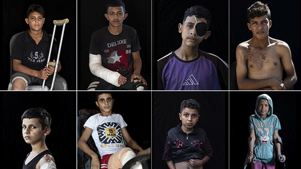 Gazze'de 5 bini aşkın çocuk ampute edildi