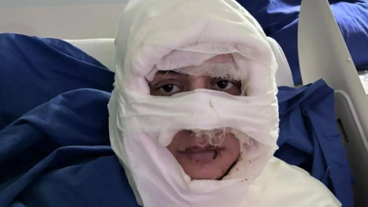 Genç kadın, başka bir kadın tarafından ateşe verildi