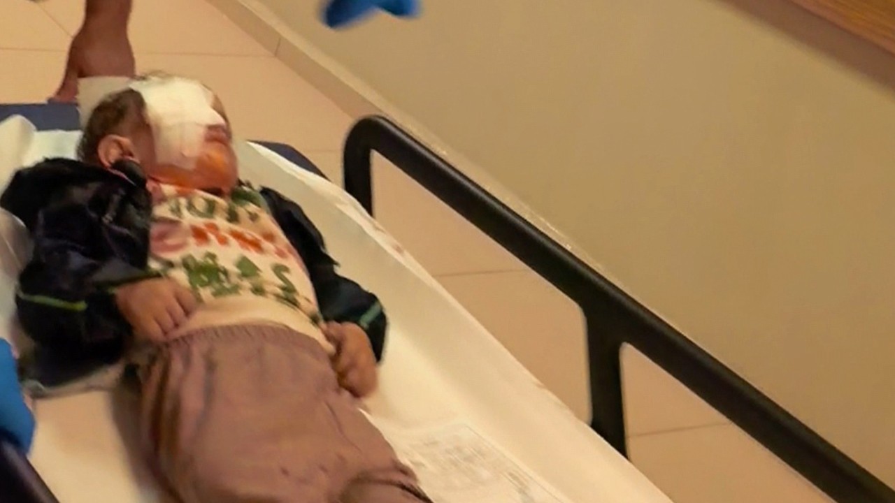 Ateşlenen torpilin patlamasıyla 2 yaşındaki Alpaslan’ın bir gözü görme yetisini kaybetti