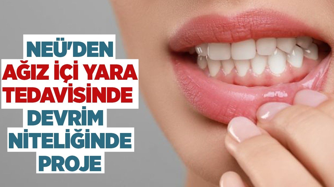 NEÜ'den ağız içi yara tedavisinde devrim niteliğinde proje