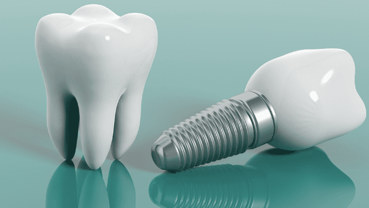 Sağlıklı Bir Gülüş İçin İzmir'de Profesyonel Diş Tedavileri