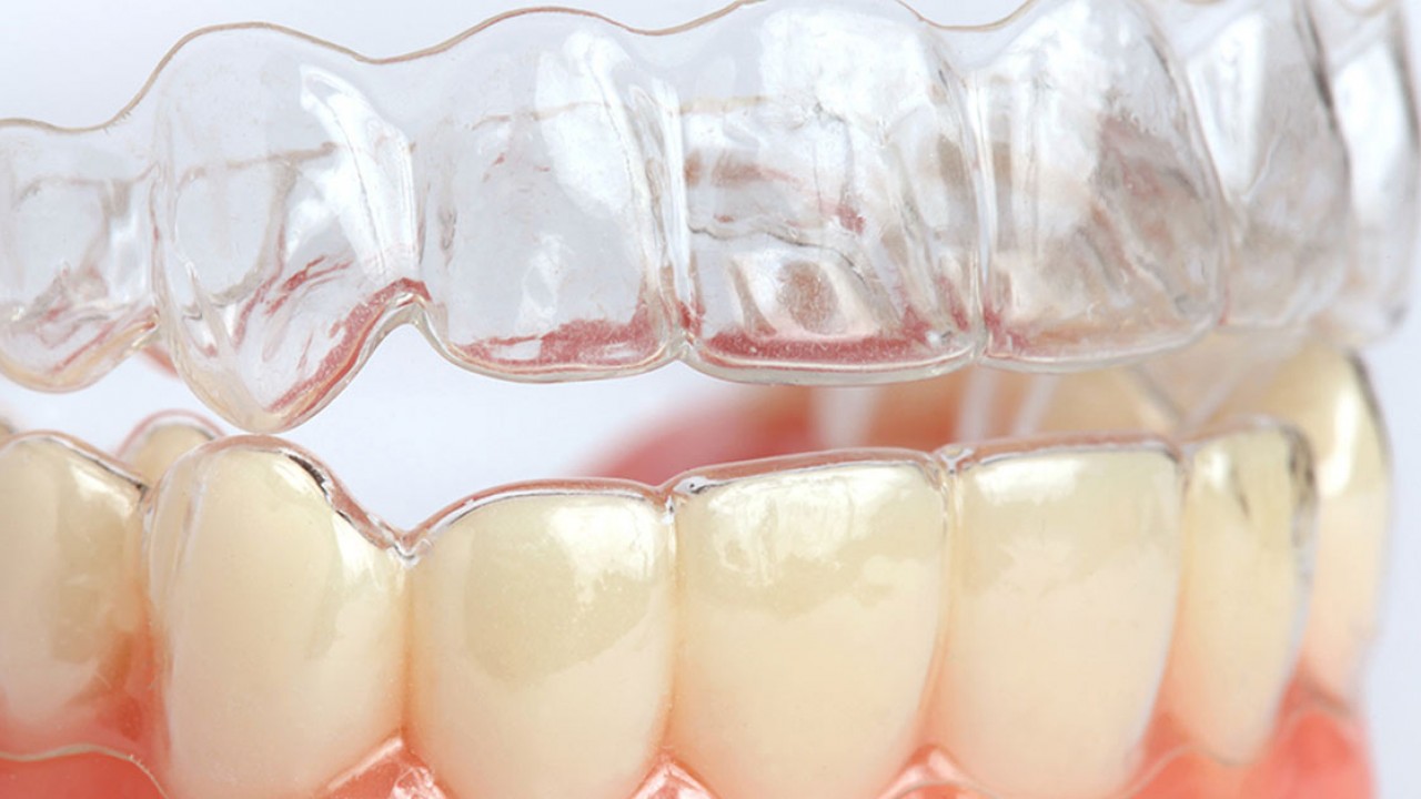 Türkiye’de Invisalign Tedavisi Yapan En İyi Klinikler
