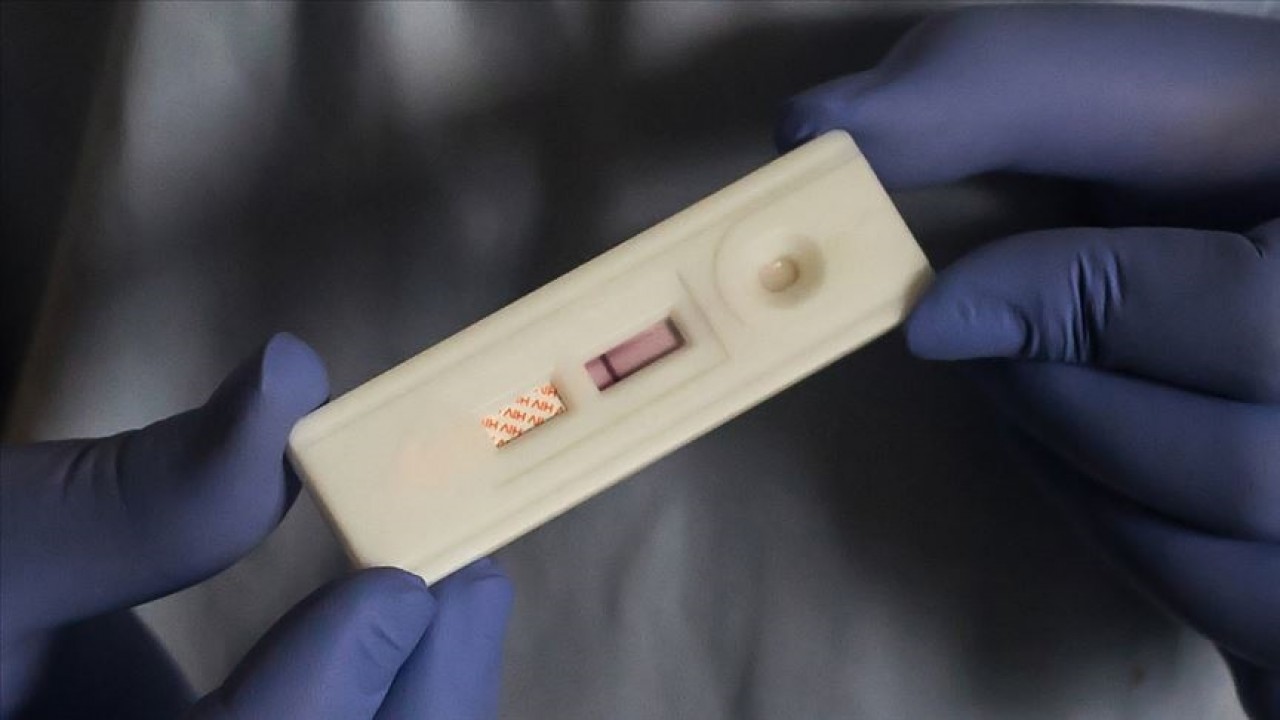 DSÖ: 2024'te 1,3 milyon kişinin AIDS hastalığına yakalandı