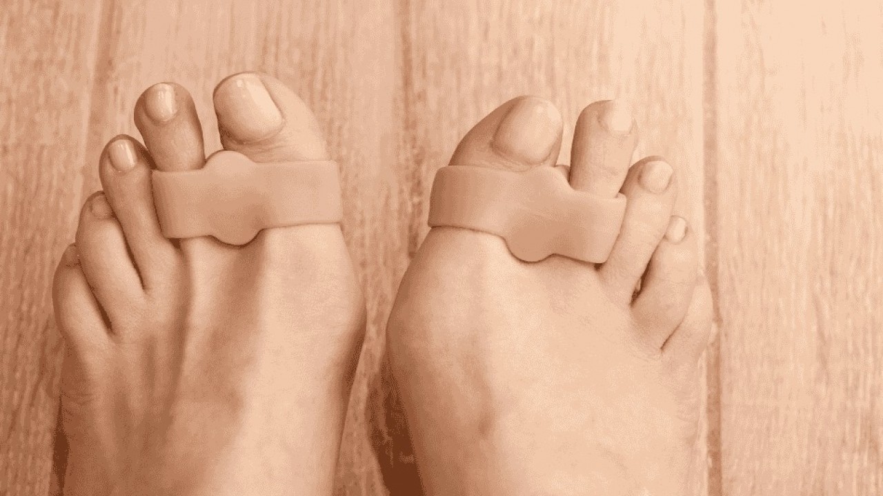 Valgus Ağrısına Ne İyi Gelir? Ameliyatsız Çözümler ve Kalıcı Tedavi