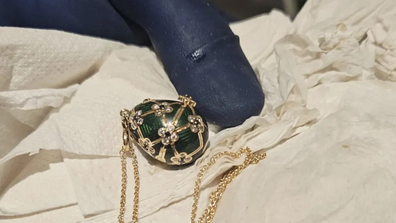 Hırsız, yuttuğu 19 bin dolarlık kolyeyi 6 günde çıkardı