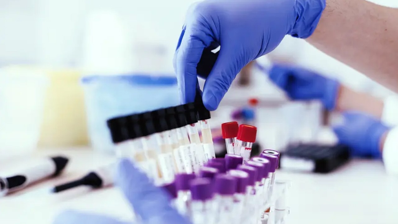 Uyuşturucu kullanımını gizlemek mümkün mü? Saç boyama, su içmek, detoks testi yanıltabilir mi?