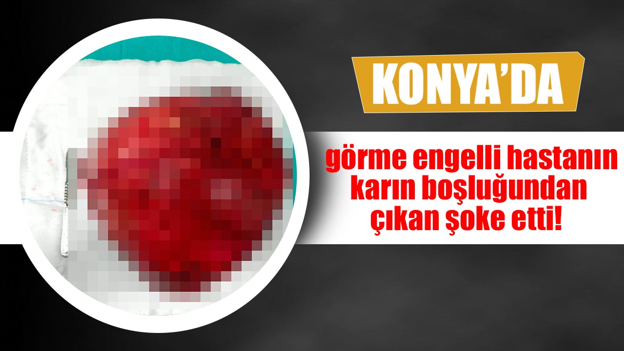 Konya'da görme engelli hastanın karın boşluğundan çıkan şoke etti!