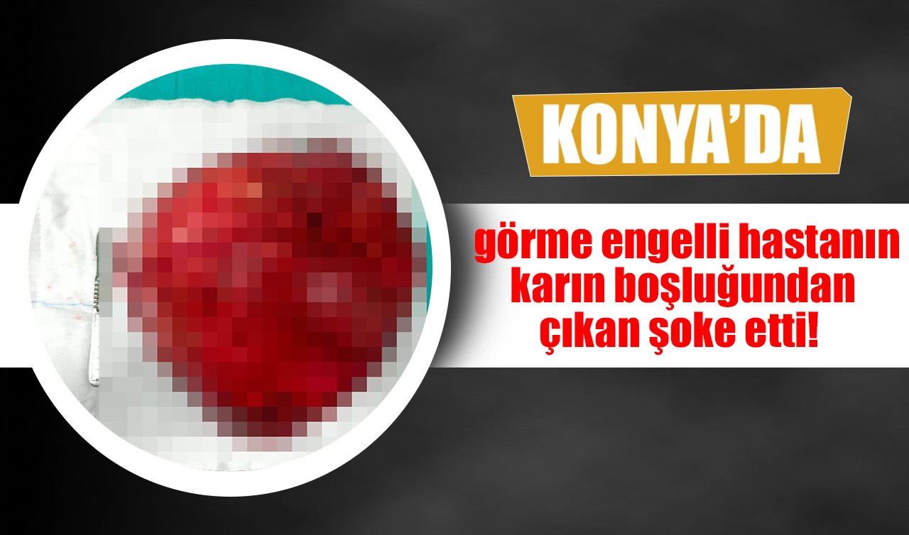 Konya'da görme engelli hastanın karın boşluğundan çıkan şoke etti!