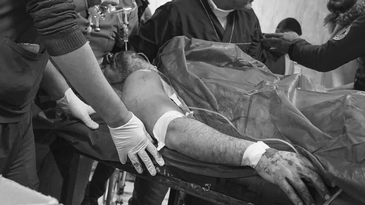 Terör örgütü YPG'nin Halep'teki saldırılarında 7 kişi öldü, 52 kişi yaralandı