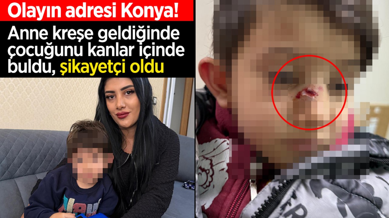 Olayın adresi Konya! Anne kreşe geldiğinde çocuğunu kanlar içinde buldu, şikayetçi oldu