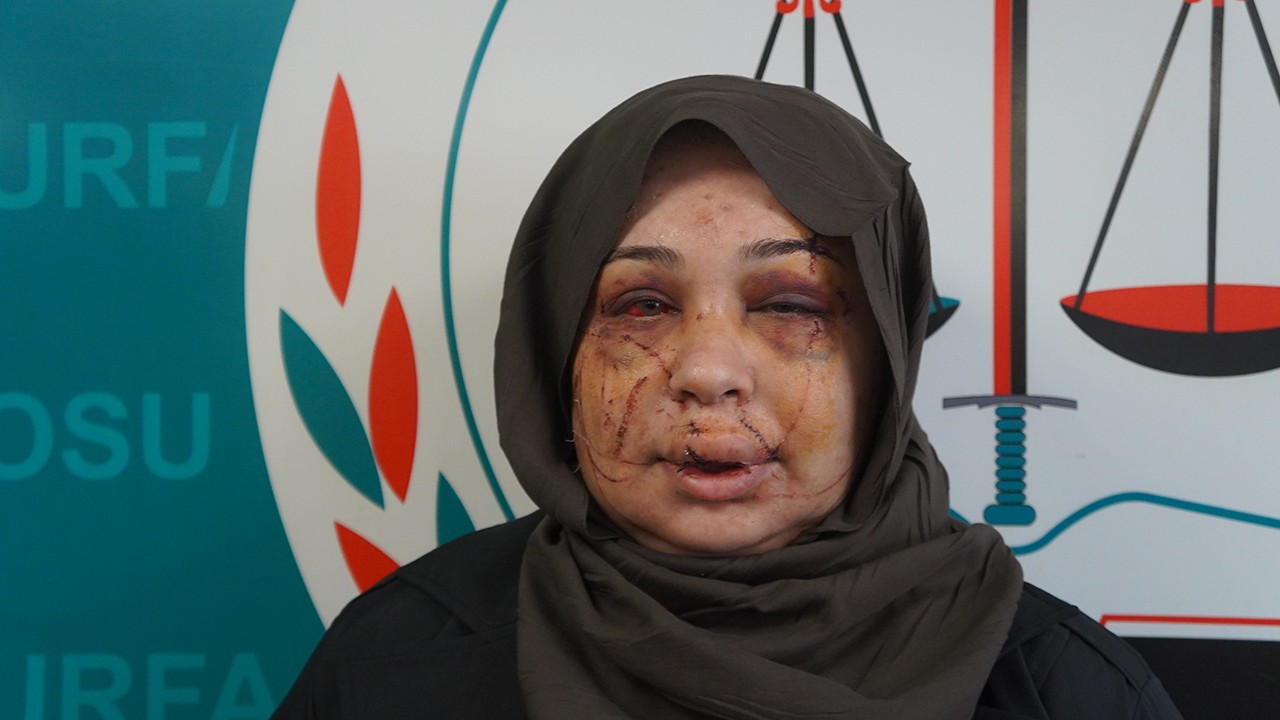 Boşanma aşamasında olduğu polis eşi dehşeti yaşattı! "Can güvenliğim yok"