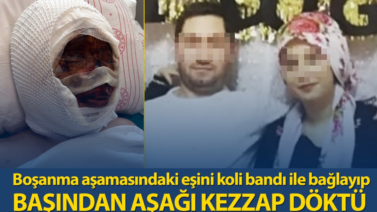 Boşanma aşamasındaki eşini koli bandı ile bağlayıp, başından aşağı kezzap döktü