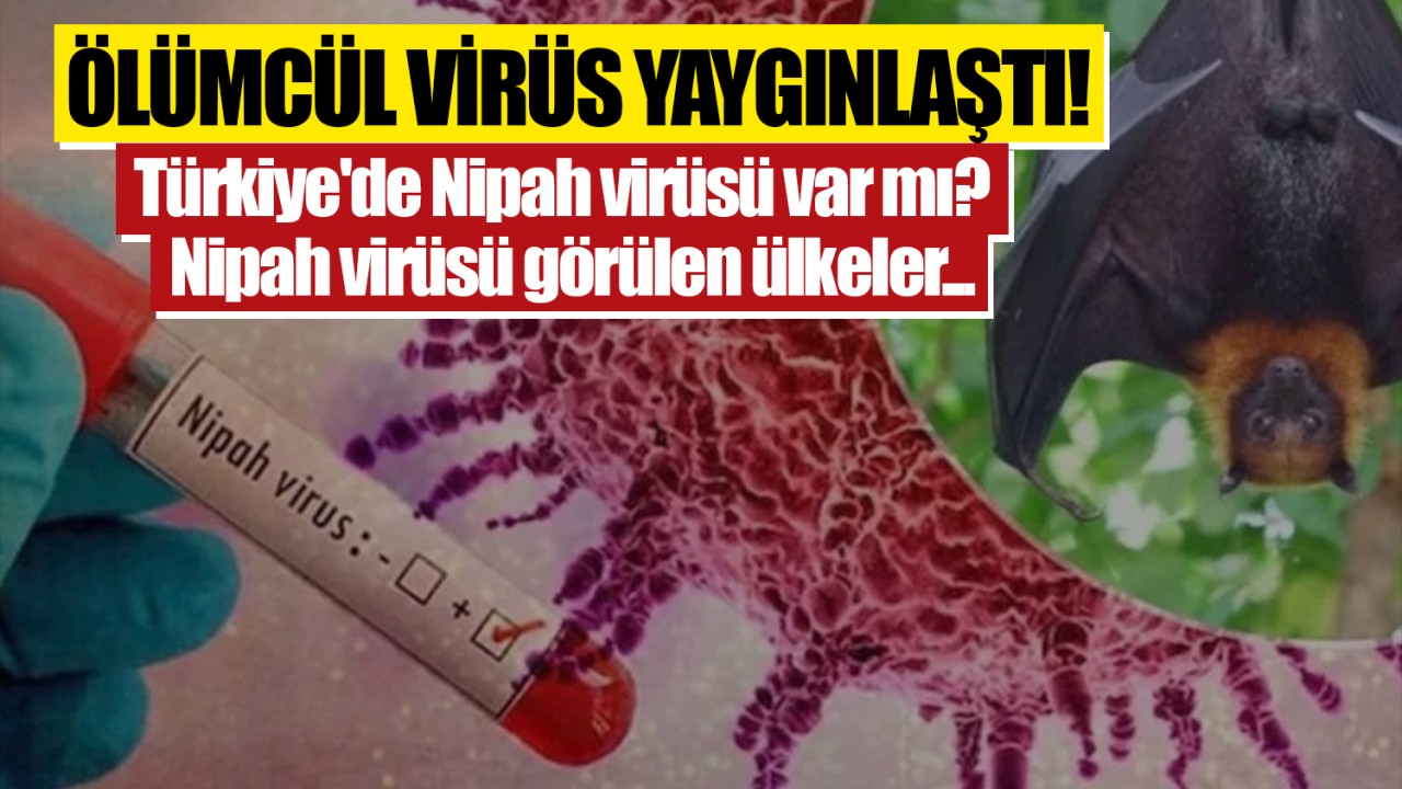 Ölümcül virüs yaygınlaştı! Türkiye'de Nipah virüsü var mı, açıklandı mı? Nipah virüsü görülen ülkeler...