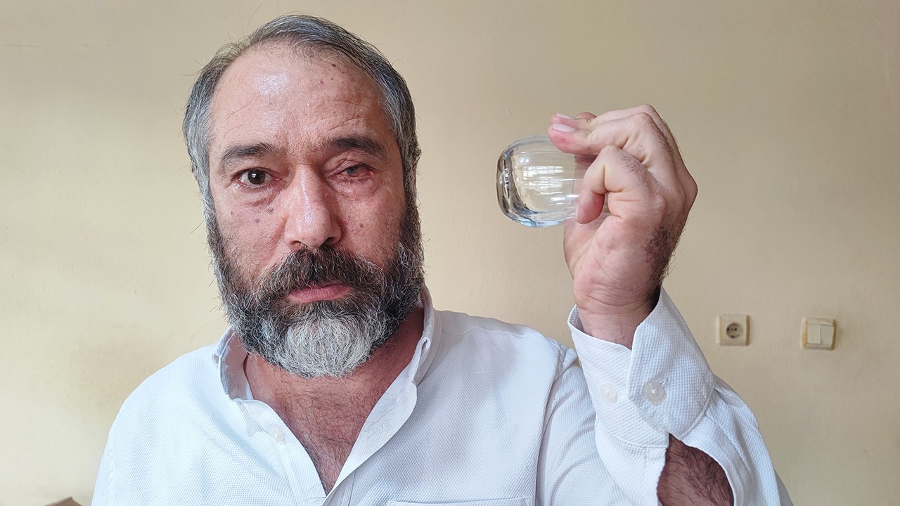 Küfür eden çaycıyı uyardı, bir gözünü kaybetti