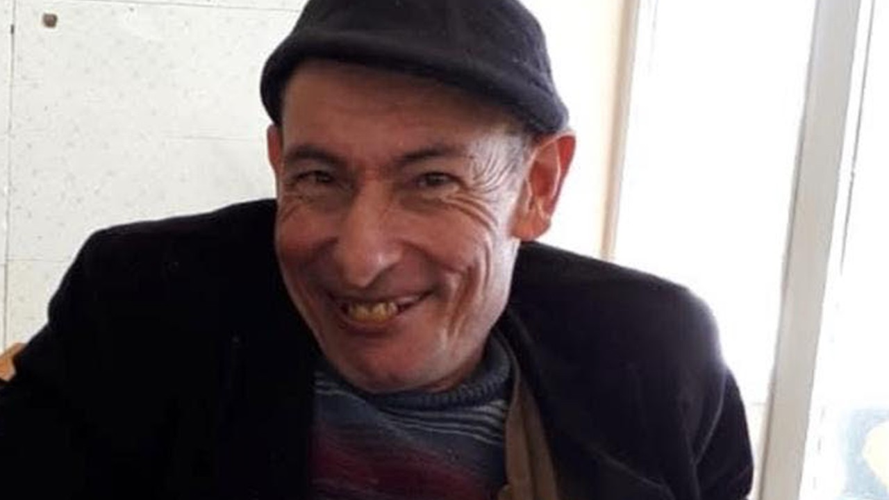 Bakımevinde bacaklarına kolonya döküp ateşe verdi