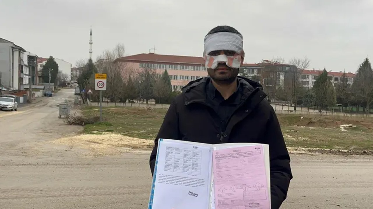 Öğretmen öğretmeni yaktı