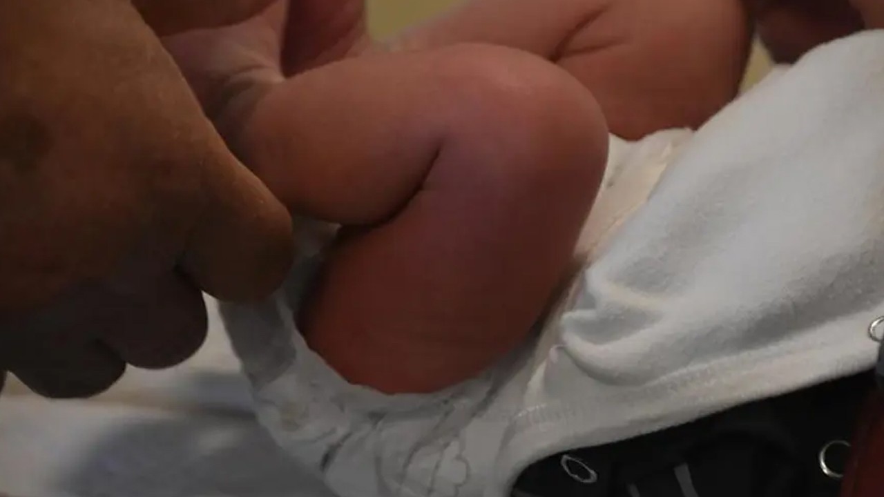 Sünnet edilen 27 günlük bebek öldü