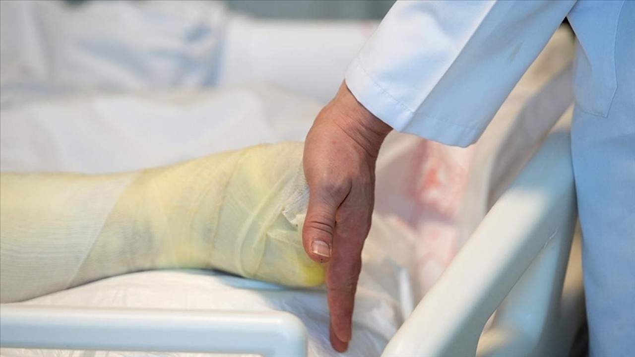 Yanıklarda en hafif ve en az yanık yanık gurubuna verilen isim hangisidir? Çifte Milyon Sorusu