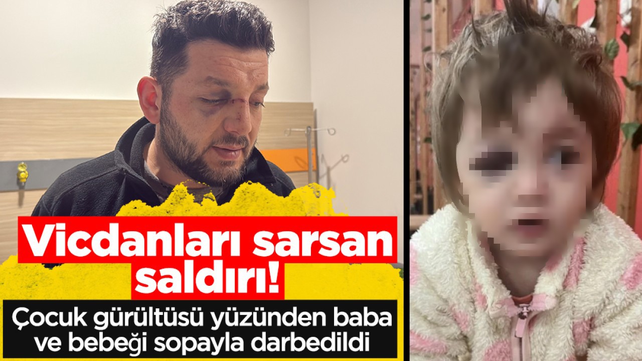Vicdanları sarsan saldırı! Çocuk gürültüsü yüzünden baba ve bebeği sopayla darbedildi