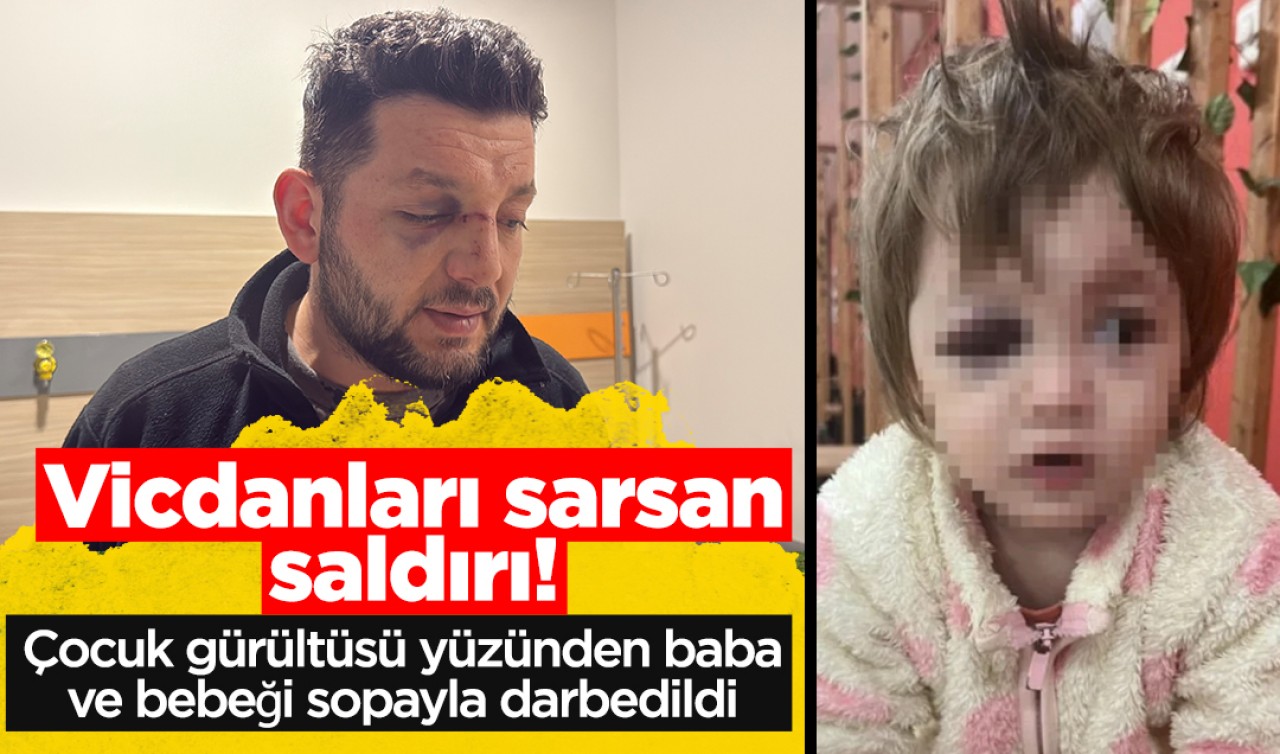 Vicdanları sarsan saldırı! Çocuk gürültüsü yüzünden baba ve bebeği sopayla darbedildi