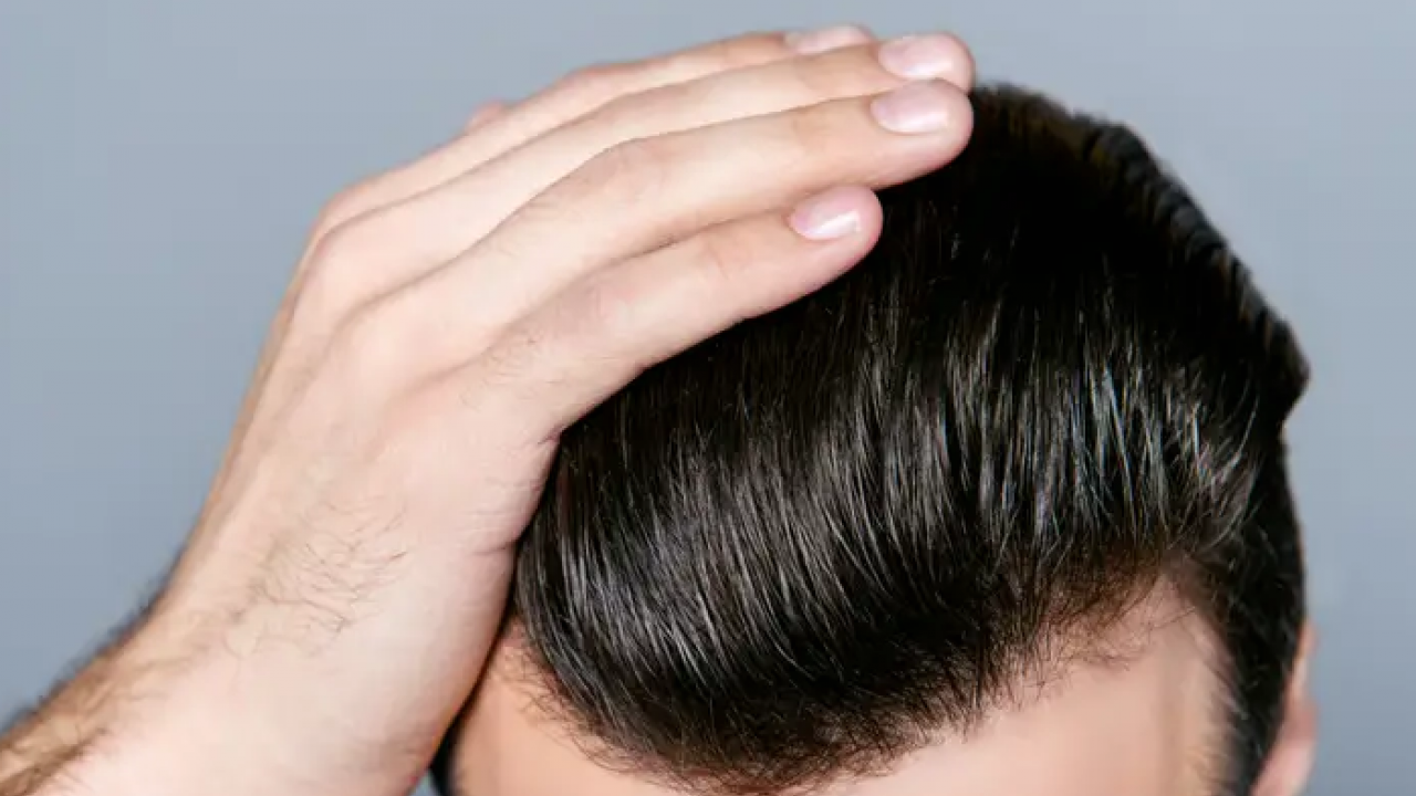 Saç Dökülmesiyle Mücadelede Güven Unsuru Neden Bu Kadar Öne Çıkıyor?