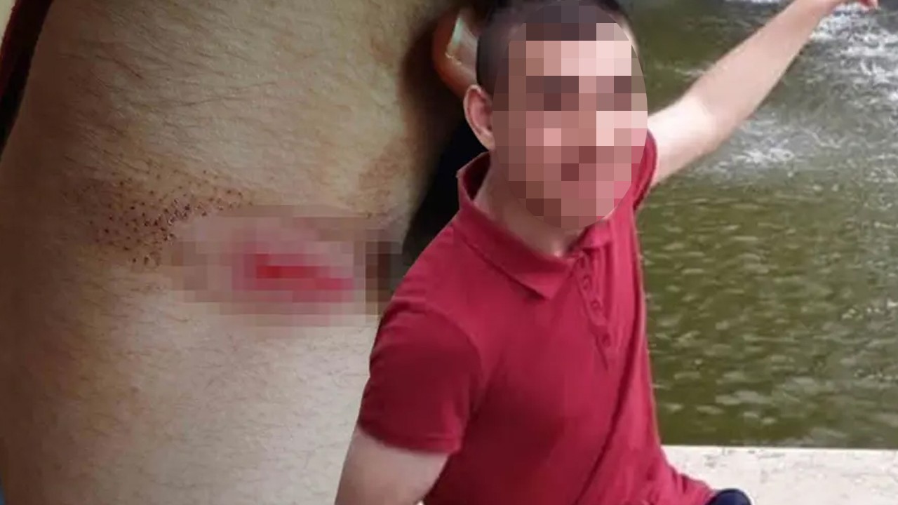 Bakımevinde ölüm davası: Engelli gence 30 kat fazla sakinleştirici verilmiş