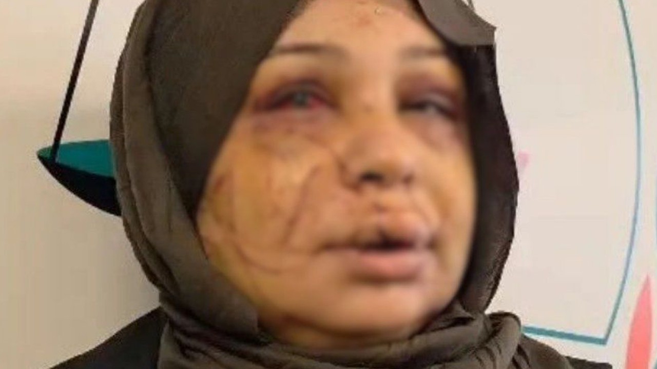 Eşinin yüzünü  keserek yaralayan polis memurunun dosyası, ağır cezaya gönderildi