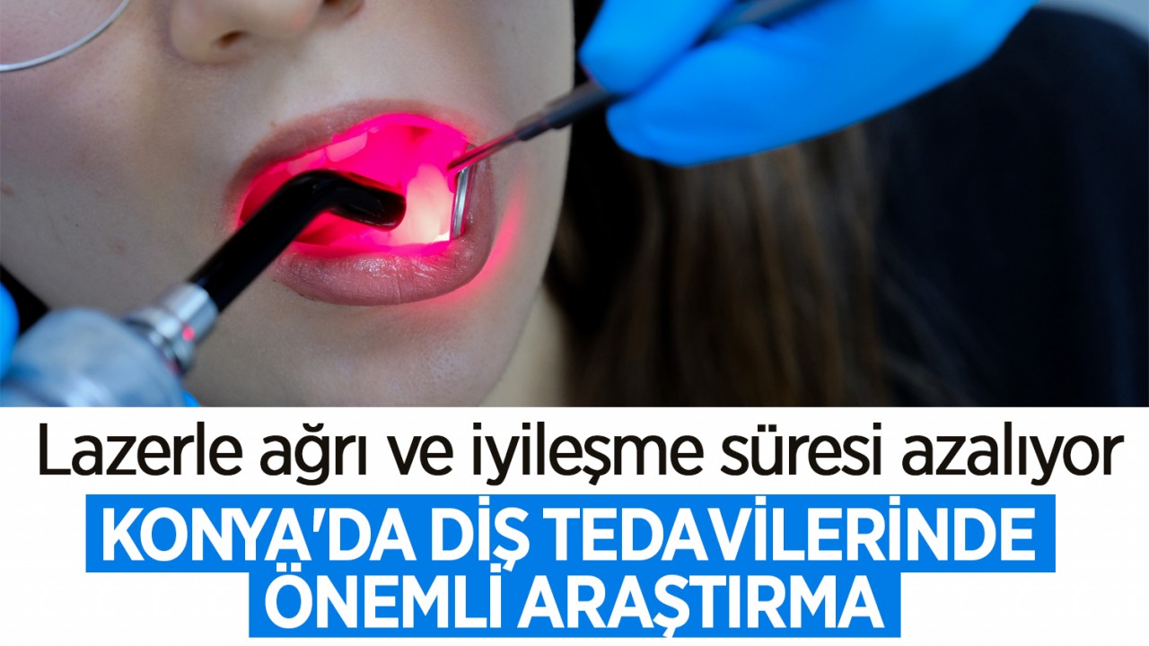 Konya'da diş tedavilerinde önemli araştırma: Lazerle ağrı ve iyileşme süresi azalıyor