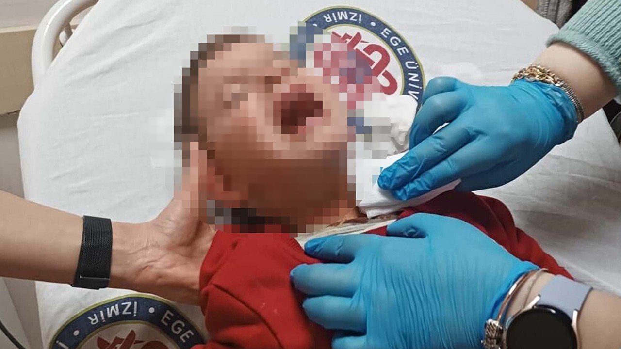 Parkta rastgele bıçak salladı! 2 yaşındaki çocuk boğazından yaralandı