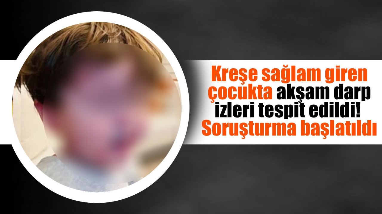 Kreşe sağlam giren çocukta akşam darp izleri tespit edildi! Soruşturma başlatıldı